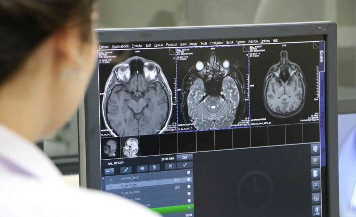 Diyarbakır’da hastalara anestezi eşliğinde MR çekimi yapılıyor