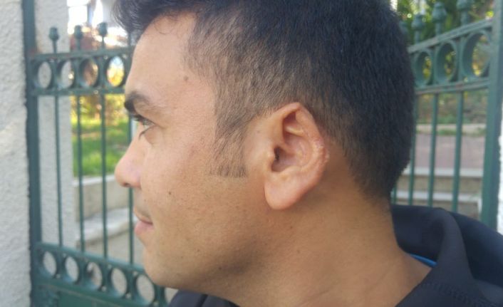 Tartıştığı şahsın kulağını ısırarak koparan sanık hakkında yakalama kararı devam ediyor