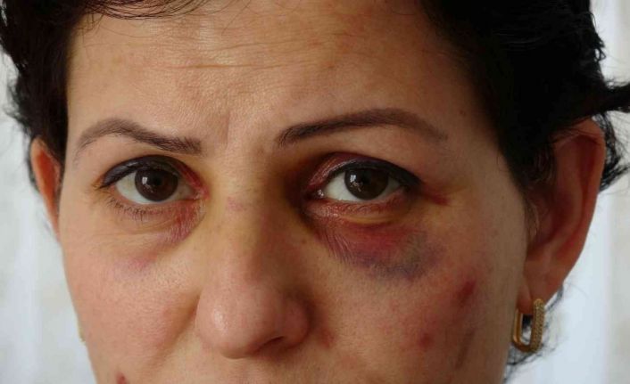 Arabayla takip edilip sokak ortasında darbedilen anne ve kızı için koruma kararı çıktı