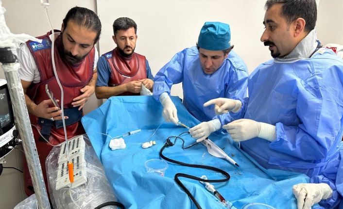 Van’da ilk kez kireçli kalp damarı ‘Rotablator’ ile temizlenerek tedavi edildi