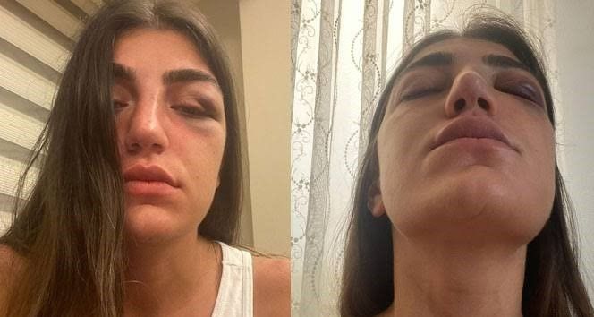 Manken Gizem Akbaş’ın darp edilmesine ilişkin davada sanığa 1 yıl hapis talebi