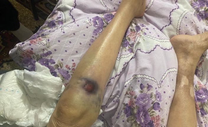 Ankara’da iki ay önce darp edildiği öne sürülen yaşlı kadın hastanede öldü