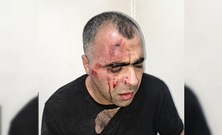 BİGACEM Başkanı Aygül’e saldırıya ilişkin 1’i polis 2 kişi gözaltına alındı