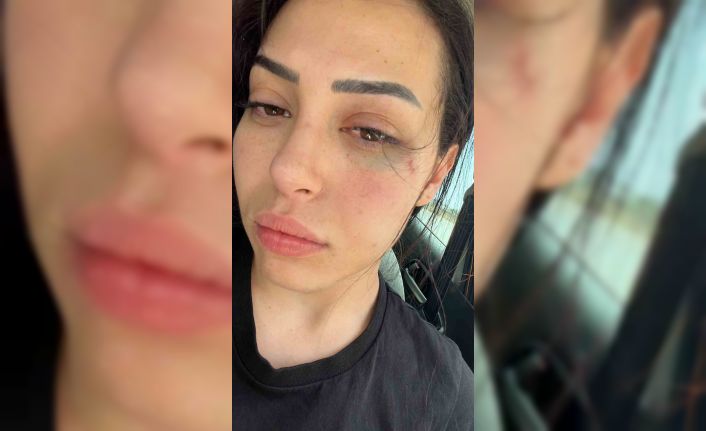 GKRY’da saldırıya uğrayan Karaali’nin duruşması 6 Temmuz’da yapılacak