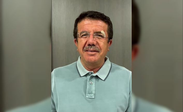 Kazada yaralanan eski bakan Zeybekci: "Şu anda gayet iyi durumdayız"