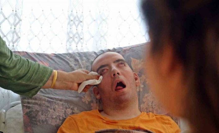 Doktorlar 6 ay ömür biçti, 10 yıldır gözlerini bir an olsun kırpmadan yaşam savaşı veriyor