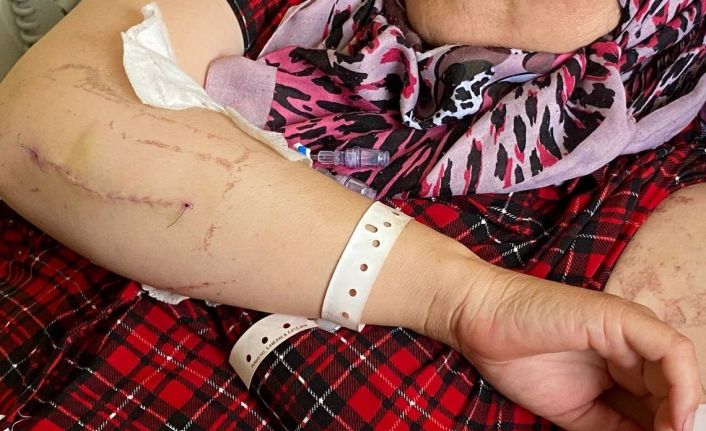 Evin elektriğini kesip kapıyı açtıran eşi tarafından 24 yerinden bıçaklandığı anları gözyaşları içinde anlattı