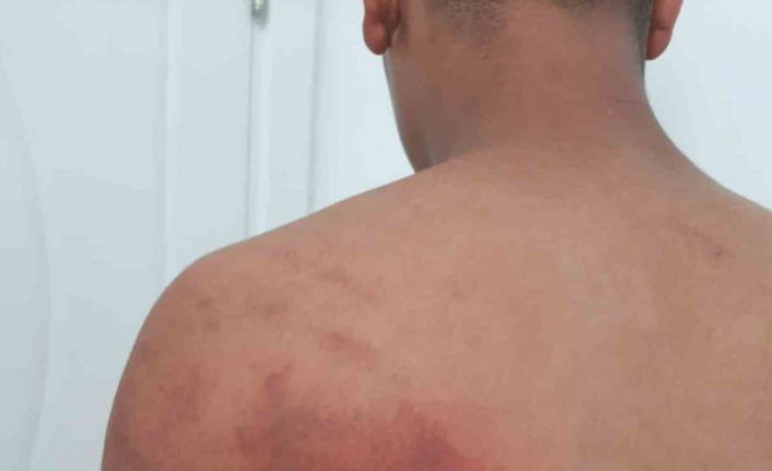 Baba ve amcanın 16 yaşındaki çocuğu zincirle bağlayıp işkence ettiği iddiası