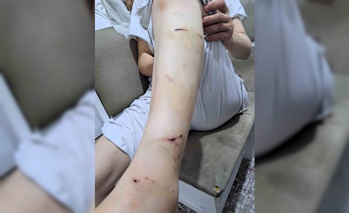 İBB Başkan danışmanı Murat Ongun’un köpeği belediye personeline 2. kez saldırınca şikayetçi olan kadın işinden oldu