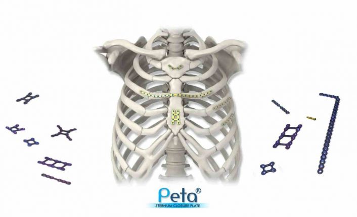 INVAMED’den göğüs kemiği kapatma plakası