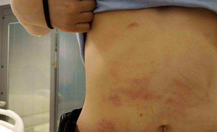 15 Temmuz Şehitler Köprüsü girişinde akıl almaz kaza kamerada: Koşan adamla çarpıştı, aracın altında sürüklendi