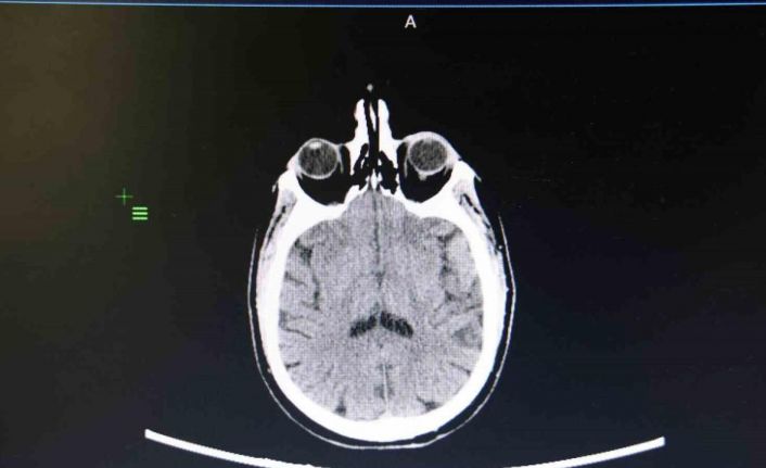 KBB Uzmanı Prof. Dr. Sakallıoğlu: "İşitme kaybının çok büyük bir kısmı tedavi edilebilmektedir"