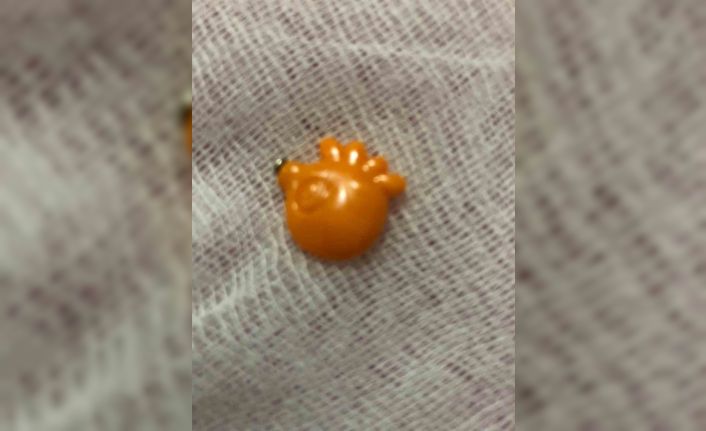 Elazığ’da 9 aylık bebeğin boğazına kaçan yabancı cisim başarıyla çıkartıldı