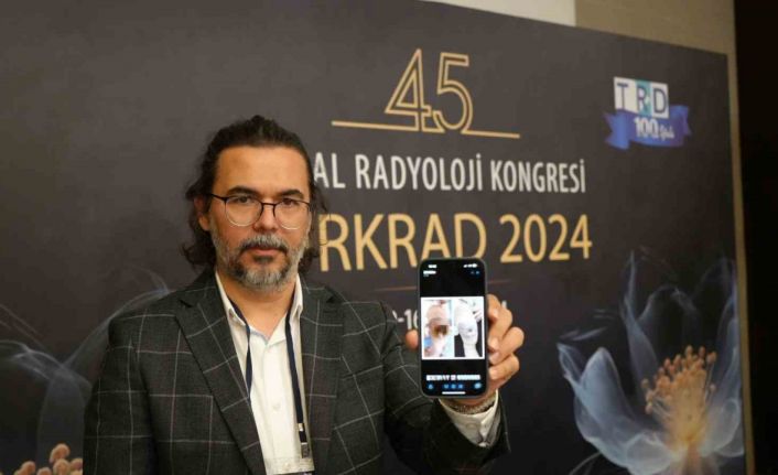 2 aylık Ayaz bebek için amputasyona giden yol girişimsel radyoloji ile kapandı