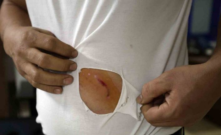 Çerkezköy’de fabrika işçisi köpeklerin saldırısından yara bere içinde kurtuldu