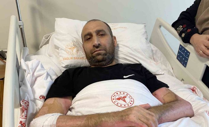 Mangal yapmak isterken ’Tiner faciası’: Vücudunun yüzde 80’i yandı, patlamanın şiddeti kameraya yansıdı