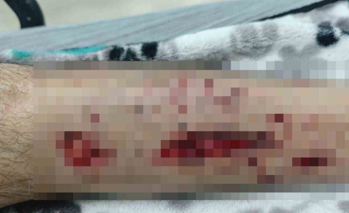 Evinin yolunu karıştıran Alzheimer hastası adam köpeklerin saldırısına uğradı