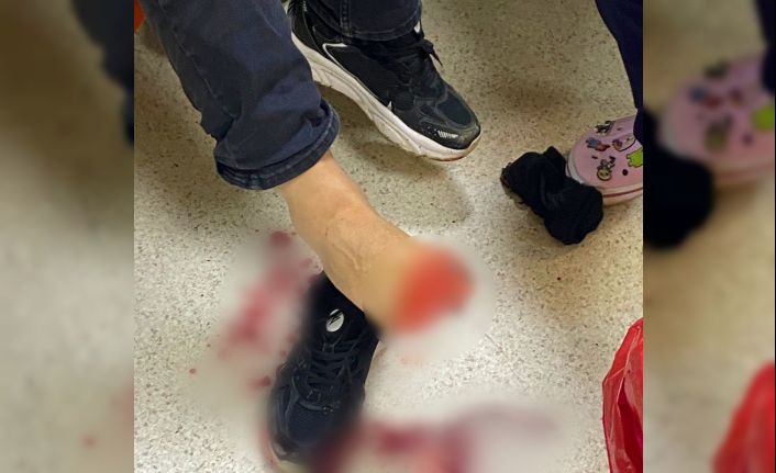 Uyuşturucu operasyonunda polise silahla ateş açıldı, 2 polis yaralandı