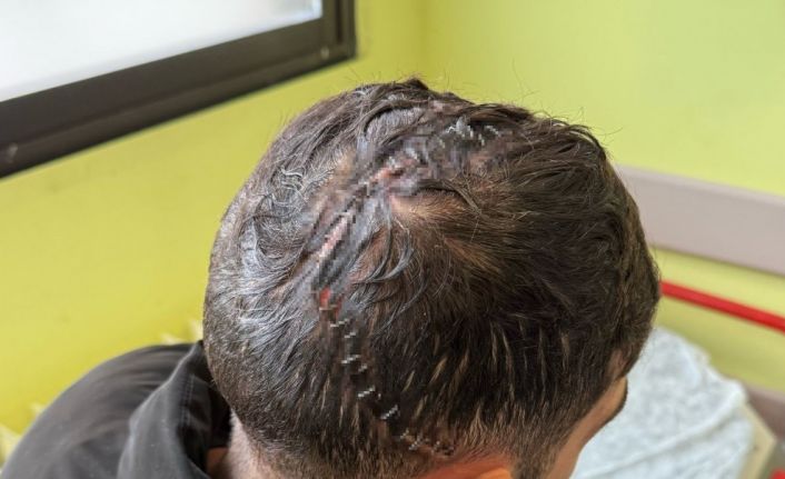 Edirne’de iş kazasında hafızasını kaybetti: Sadece annesini hatırlıyor