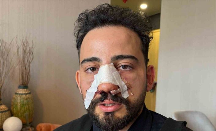 Siparişler geciktiği için gitmek isteyen müşteriye restoran çalışanlarından öldüresiye darp