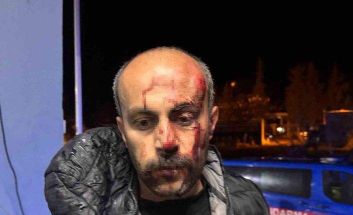 Şanlıurfa’da müvekkilinin yanına giden avukata darp iddiası