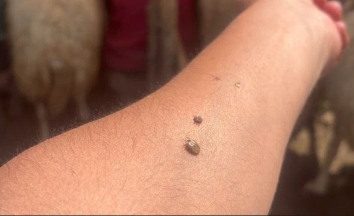 Erzincan’da KKKA uyarısı: Kene temasına karşı dikkatli olun!