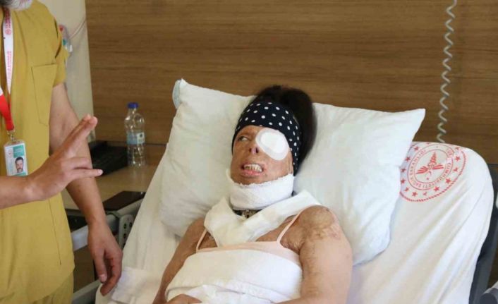 Genç kadının hayatı kezzapla karardı