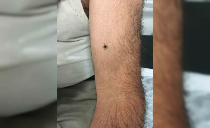 Kayseri’nin bir ilçesinde daha kene vakası