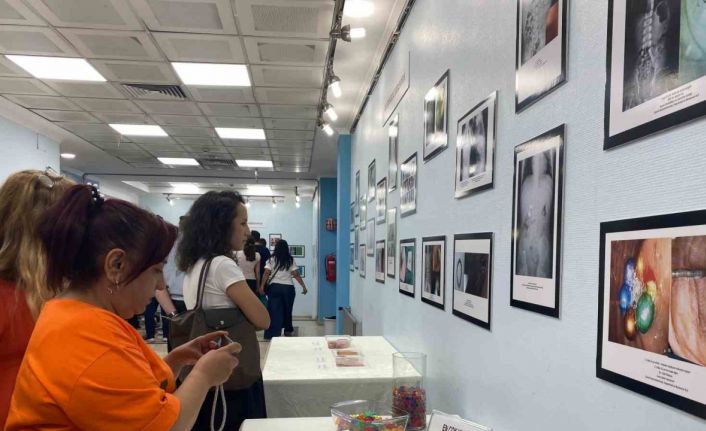 Prof. Dr. Dalgıç: "Aileler, özellikle 8 ve 9’uncu aylardan itibaren küçük maddeleri etrafta bulundurmamalılar"