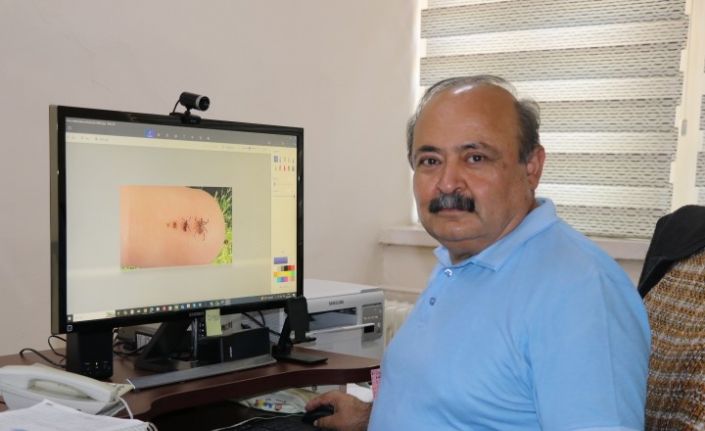 Sıcak hava keneleri harekete geçirdi: 1 kene, 10 bine yakın yumurta bırakabiliyor