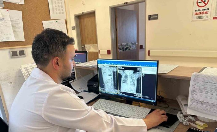 Çekirdek kabukları yutması sonucu nefessiz kalan bebek yapılan ameliyatla kurtarıldı