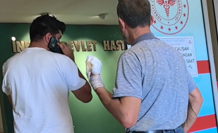 Elini bıçkıya kaptıran adamın parmakları parçalandı