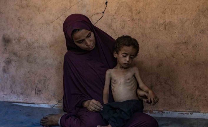 Gazze’de açlık nedeniyle hayatını kaybedenlerin sayısı 113’e yükseldi