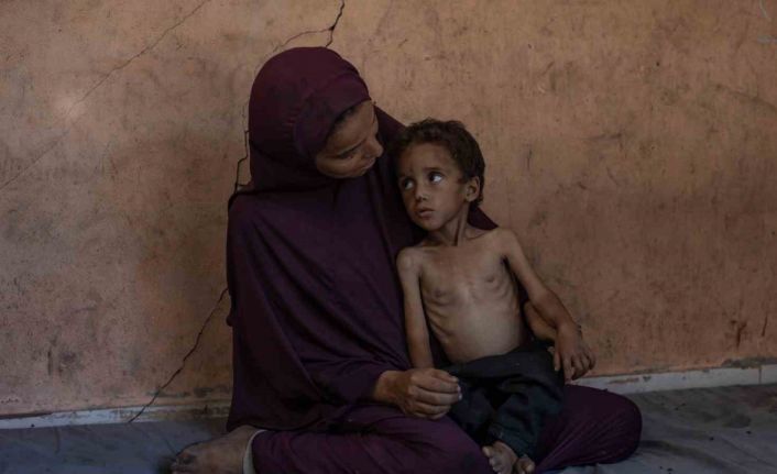 Gazze’de açlık nedeniyle hayatını kaybedenlerin sayısı 127’ye yükseldi