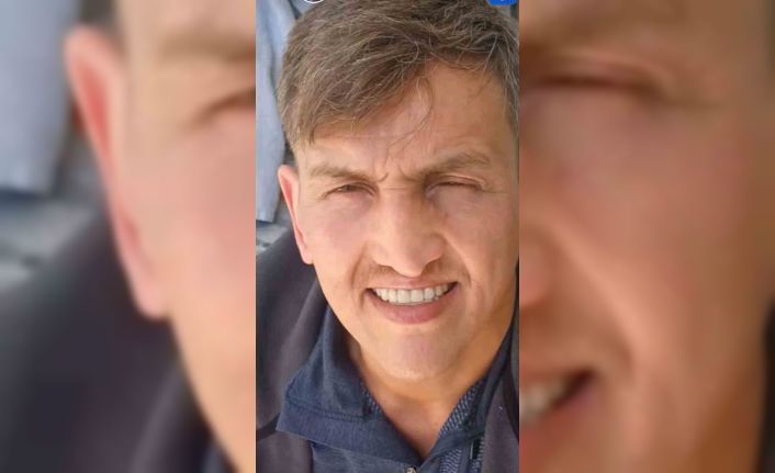 İstanbul’da burun estetiği ameliyatının ardından hayatını kaybetti