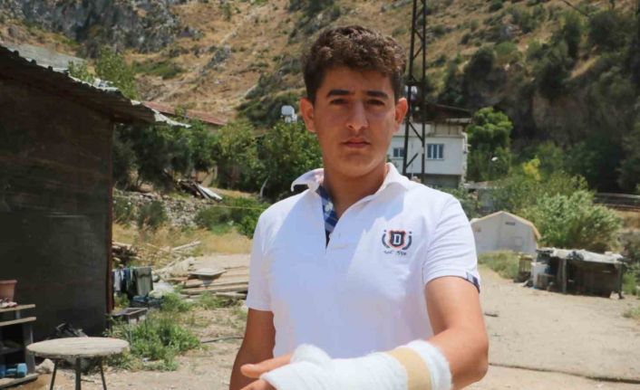 Orman yangınında alevler evine sıçramasın can pahasına diye mücadele veren çocuğun elini yamaçtan kopan kaya parçası kırdı