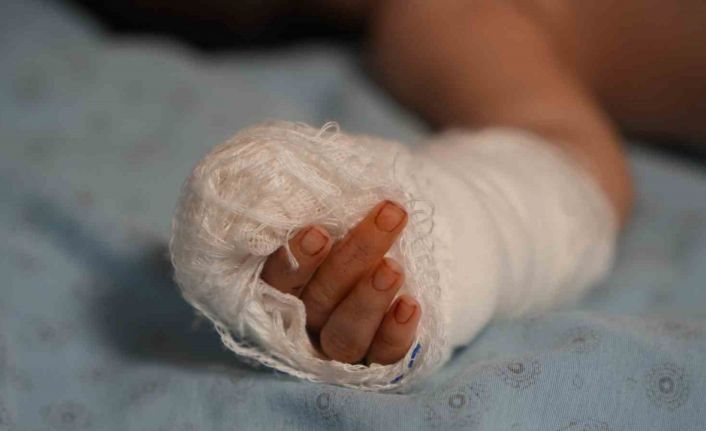 Serum kelebeğini çıkarmak isterken bebeğin parmağını kesti