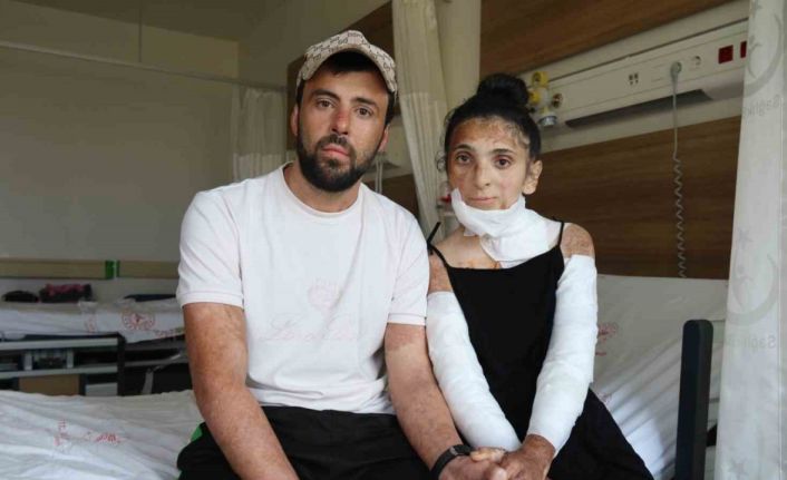 Azerbaycanlı çiftin doğal gaz patlamasında kapanan elleri, 3 yıl sonunda Eskişehir’deki tedaviyle kavuştu