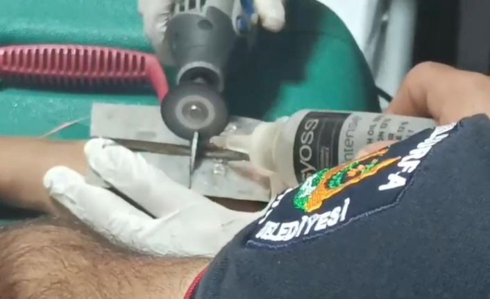 Çocuğun parmağına sıkıştırdığı cıvata pulu kesilerek çıkartıldı
