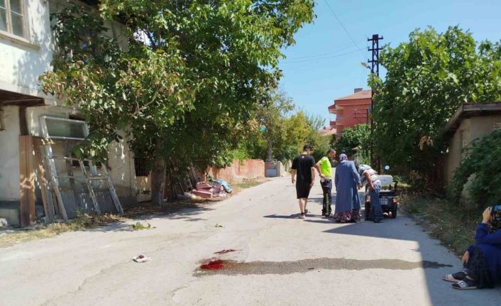 Çorum’da elektrikli motosiklet kazası: 1 yaralı