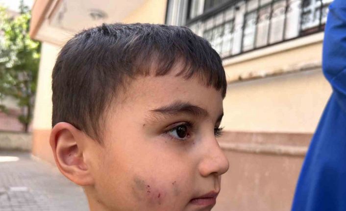 Evde uyuyan çocuğu lağım faresi ısırdı