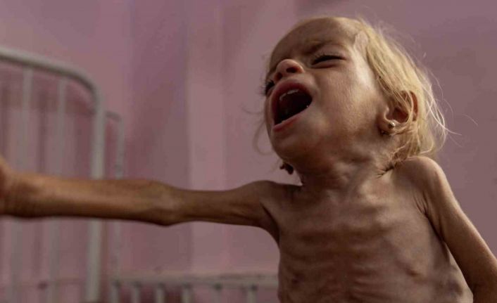 Gazze’de 3 Filistinli daha açlık nedeniyle hayatını kaybetti