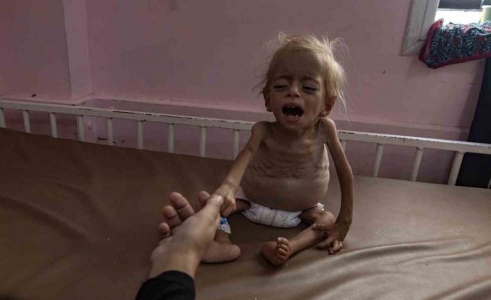 Gazze’de 8 sivil daha açlık nedeniyle hayatını kaybetti