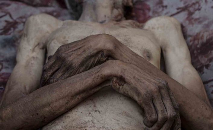 Gazze’de son 24 saatte 6 kişi daha açlık nedeniyle hayatını kaybetti