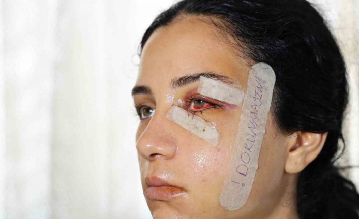 Eski eşini dövüp serbest kalan şüpheli tutuklandı