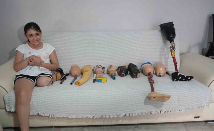 Okulların açılmasına günler kala 12 yaşındaki Özge’ye dar gelen protez bacak engeli