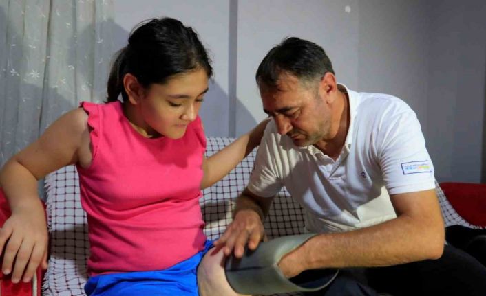 Protez bacağı dar gelen Özge için Türkiye ayağa kalktı