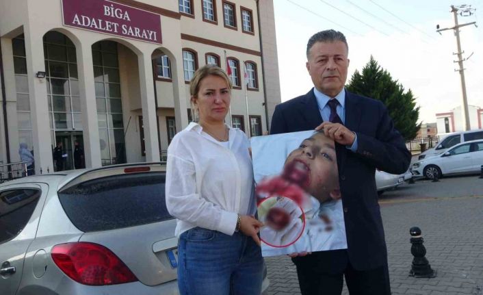 İlkokul öğrencisinin çenesi saplanan demir yüzünden koptu, ailesi okula ihmal davası açtı