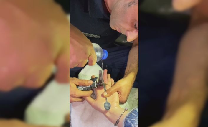 Parmağına yüzük sıkışan vatandaşın imdadına itfaiye ekipleri yetişti