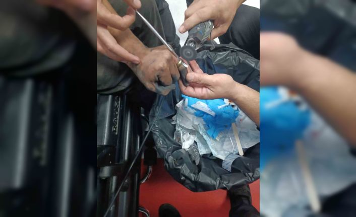 Parmakta sıkışan yüzük, hastanede doktor ve itfaiye ekibi tarafından çıkartıldı